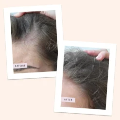 Hair Gain Scalp Foam 50ml