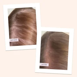 Hair Gain Scalp Foam 50ml
