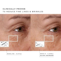 HigherDOSE Red Light Face Mask