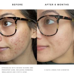 HigherDOSE Red Light Face Mask