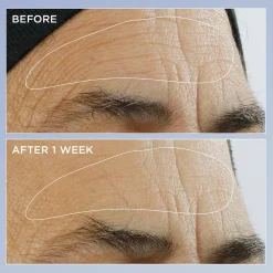 High Potency Triple Retinol Renewal Serum