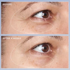 High Potency Triple Retinol Renewal Eye Serum