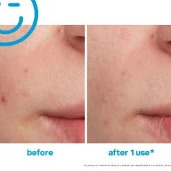 Kate Somerville EradiKate Blemish Treatment 30ml