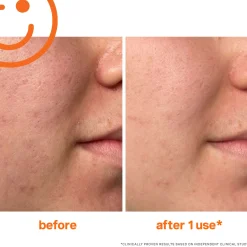 Kate Somerville ExfoliKate Intensive Exfoliating Treatment 60ml