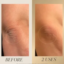 Kate Somerville Exfolikate Resurfacing Body Scrub 150ml