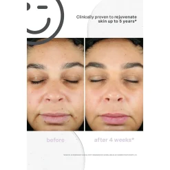 Kate Somerville KateCeuticals SuperCell Rejuvenation Serum 30ml