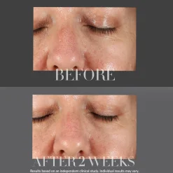 Kate Somerville KateCeuticals Resurfacing Overnight Peel 30ml