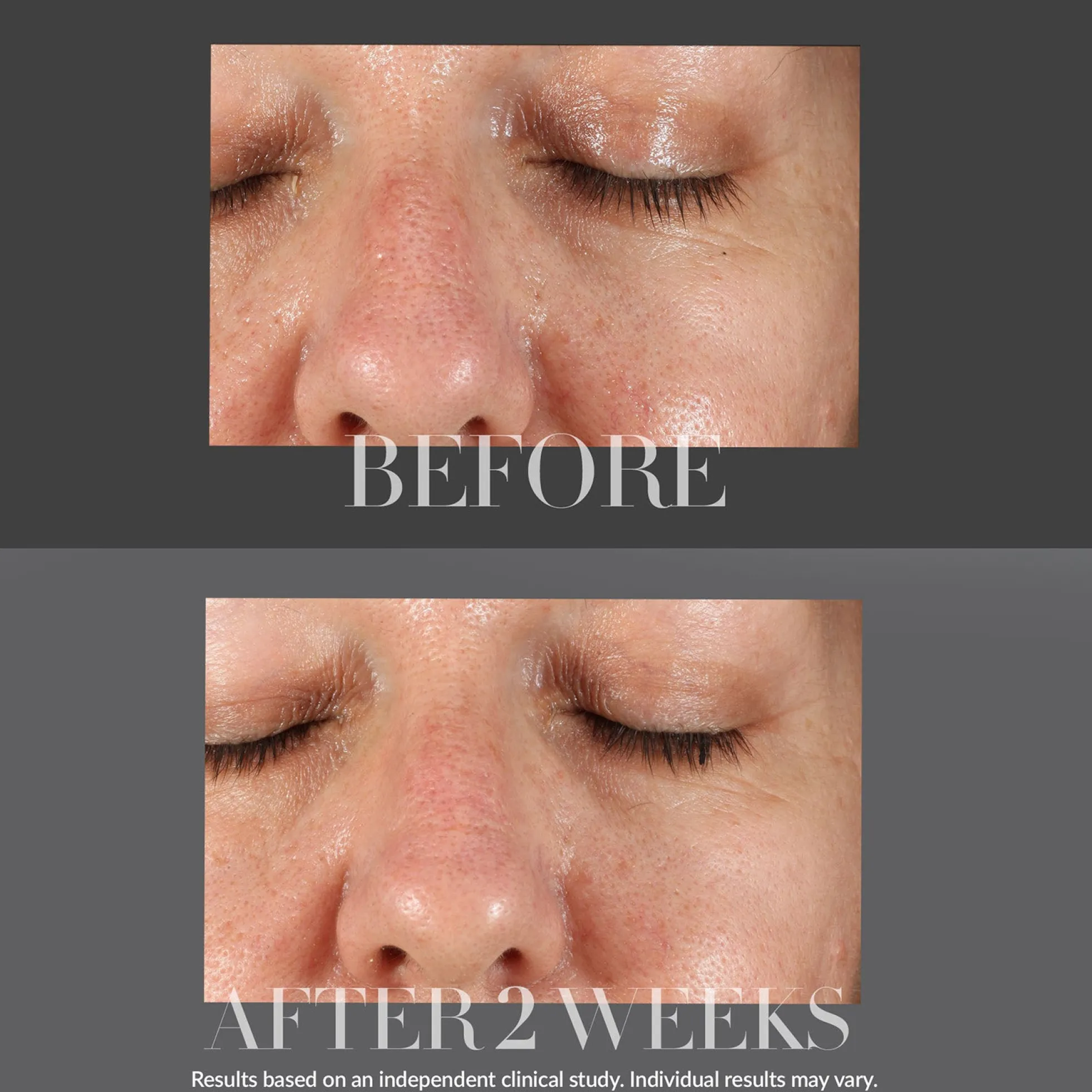 Kate Somerville KateCeuticals Resurfacing Overnight Peel 30ml