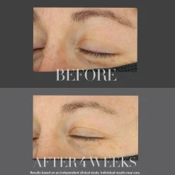 Kate Somerville KateCeuticals Lifting Eye Cream 15ml