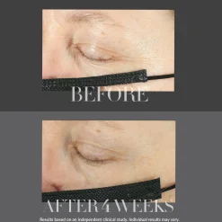 Kate Somerville KateCeuticals Lifting Eye Cream 15ml