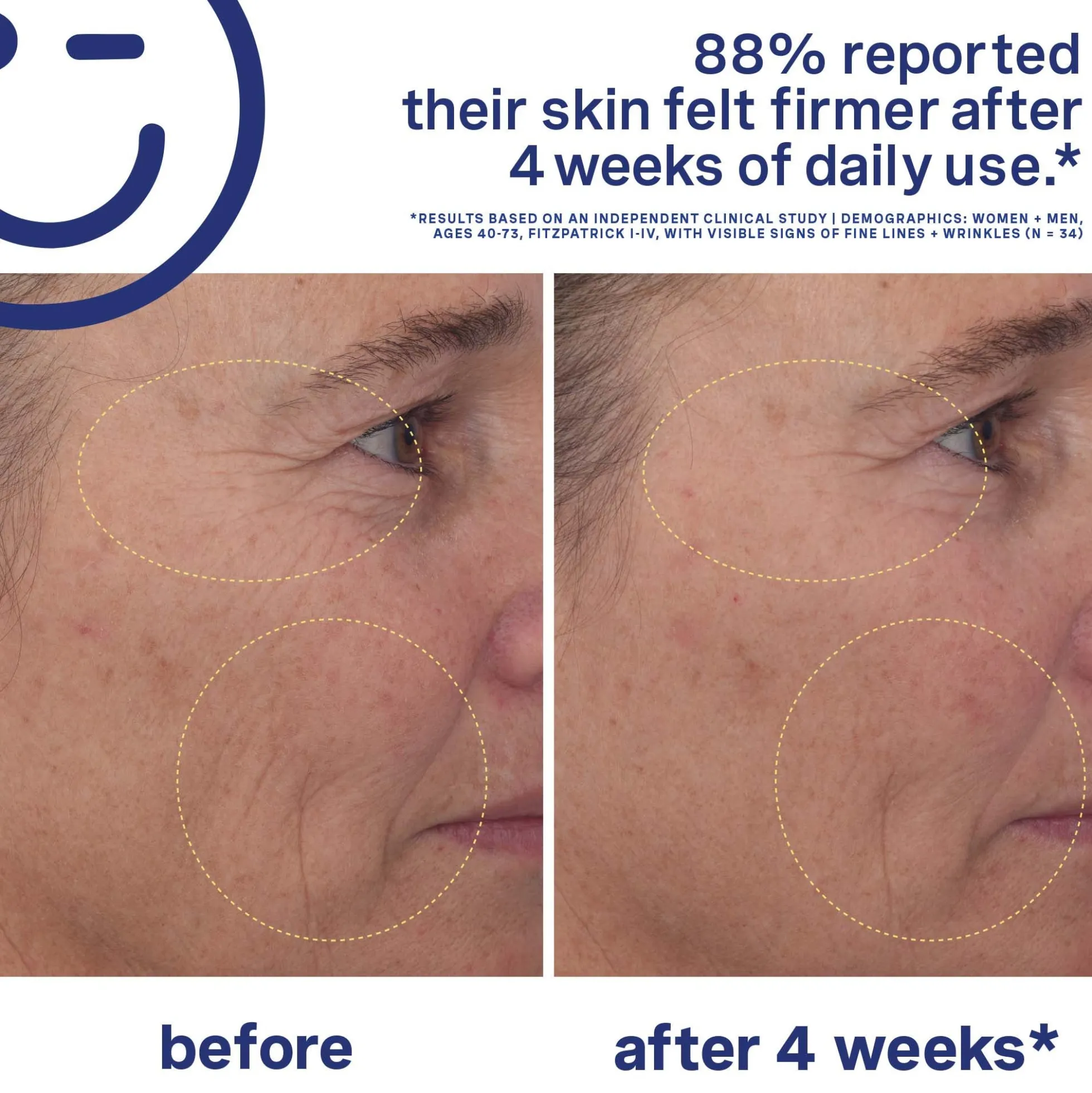 Kate Somerville Mega-A Retinal Skin Transforming Serum 30ml