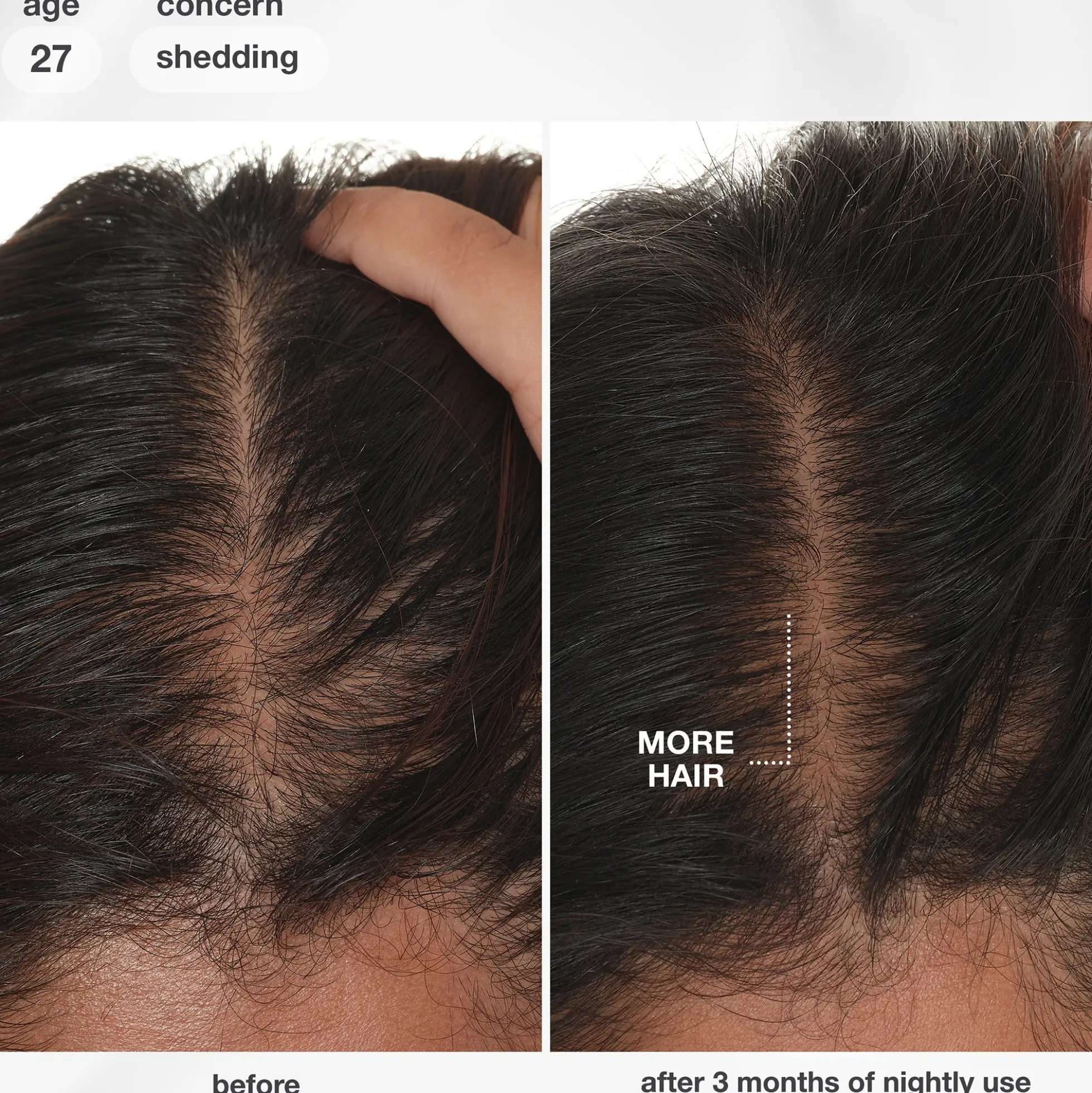 K18 Biomimetic Hairscience FutureIQ Biomimetic Hair Longevity Serum 90ml