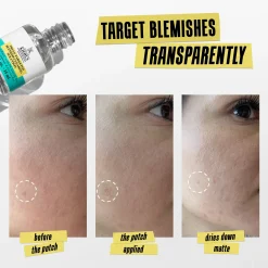 Kiehl's Truly Targeted Blemish-Clearing Solution 15ml
