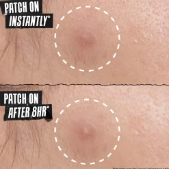 Kiehl's Truly Targeted Overnight Blemish Patch