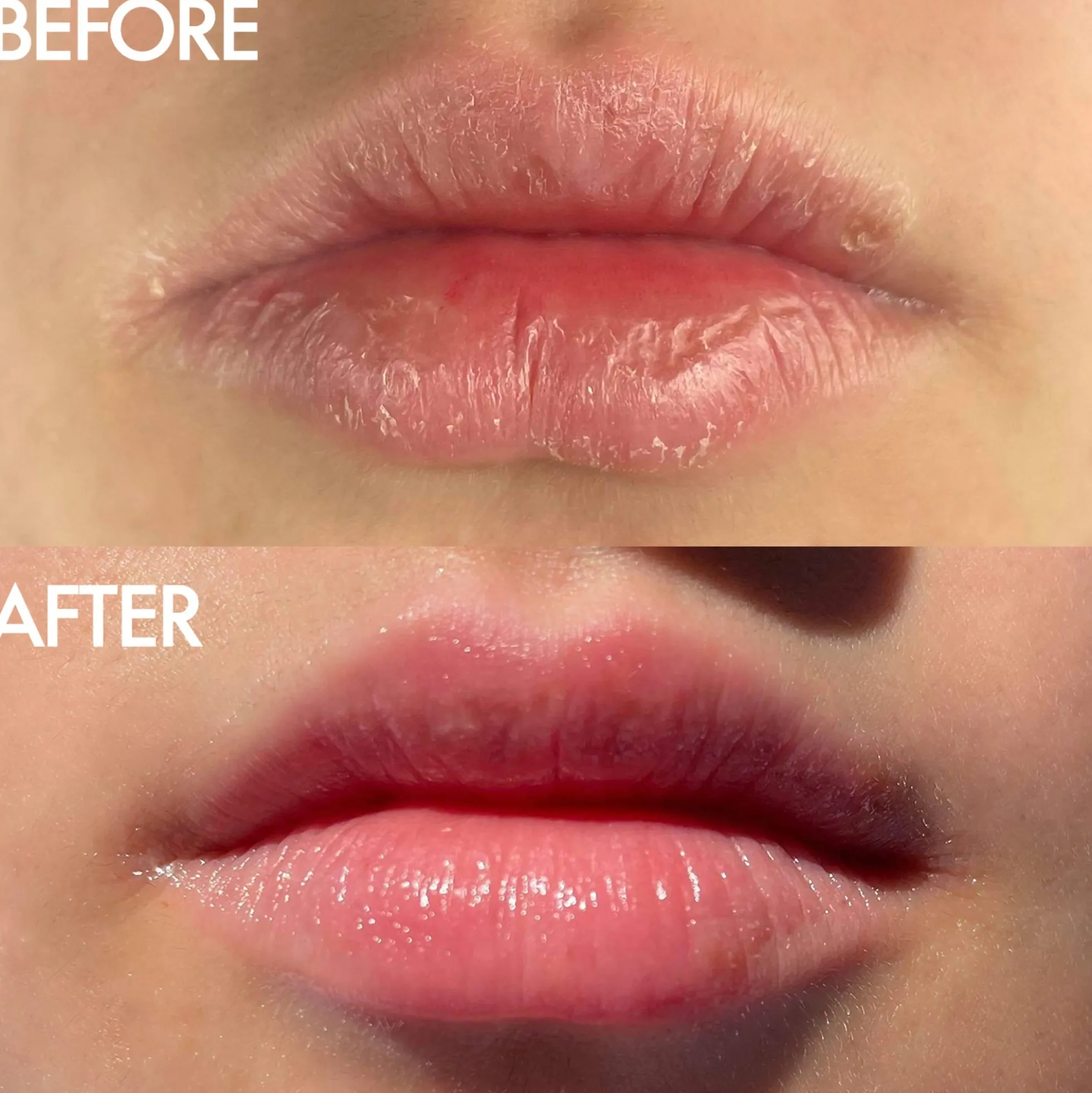 Lanolips The Original 101 Ointment