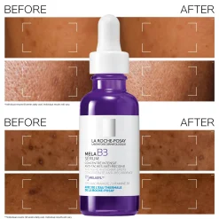 La Roche-Posay Anthelios Anti-Dark Spot Bundle