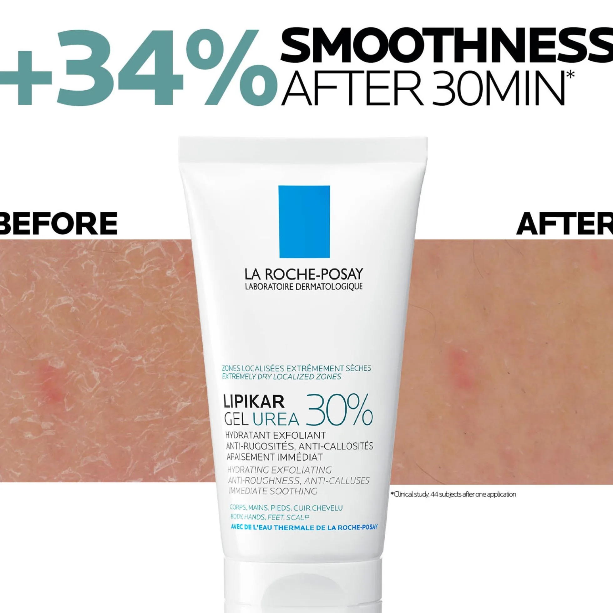 La Roche Posay Lipikar Urea 30% Exfoliating Moisturising Gel 50ml
