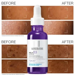 La Roche-Posay MelaB3 Serum: Intense Anti-Dark Spot Serum for Hyperpigmentation 30ml