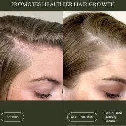 Living Proof Scalp Care Density Serum 50ml
