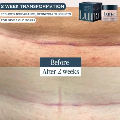 Luna Daily The Skin Repair Treatment for Scars and Hyperpigmentation 50ml