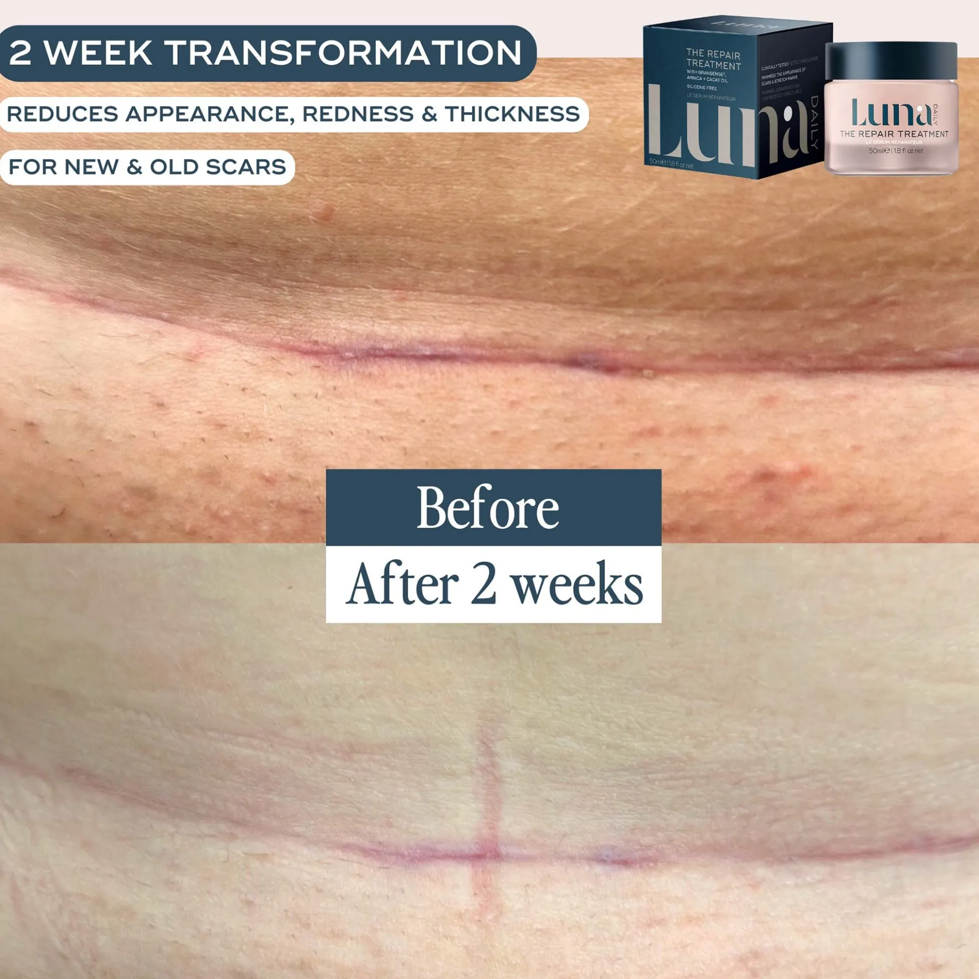Luna Daily The Skin Repair Treatment for Scars and Hyperpigmentation 50ml