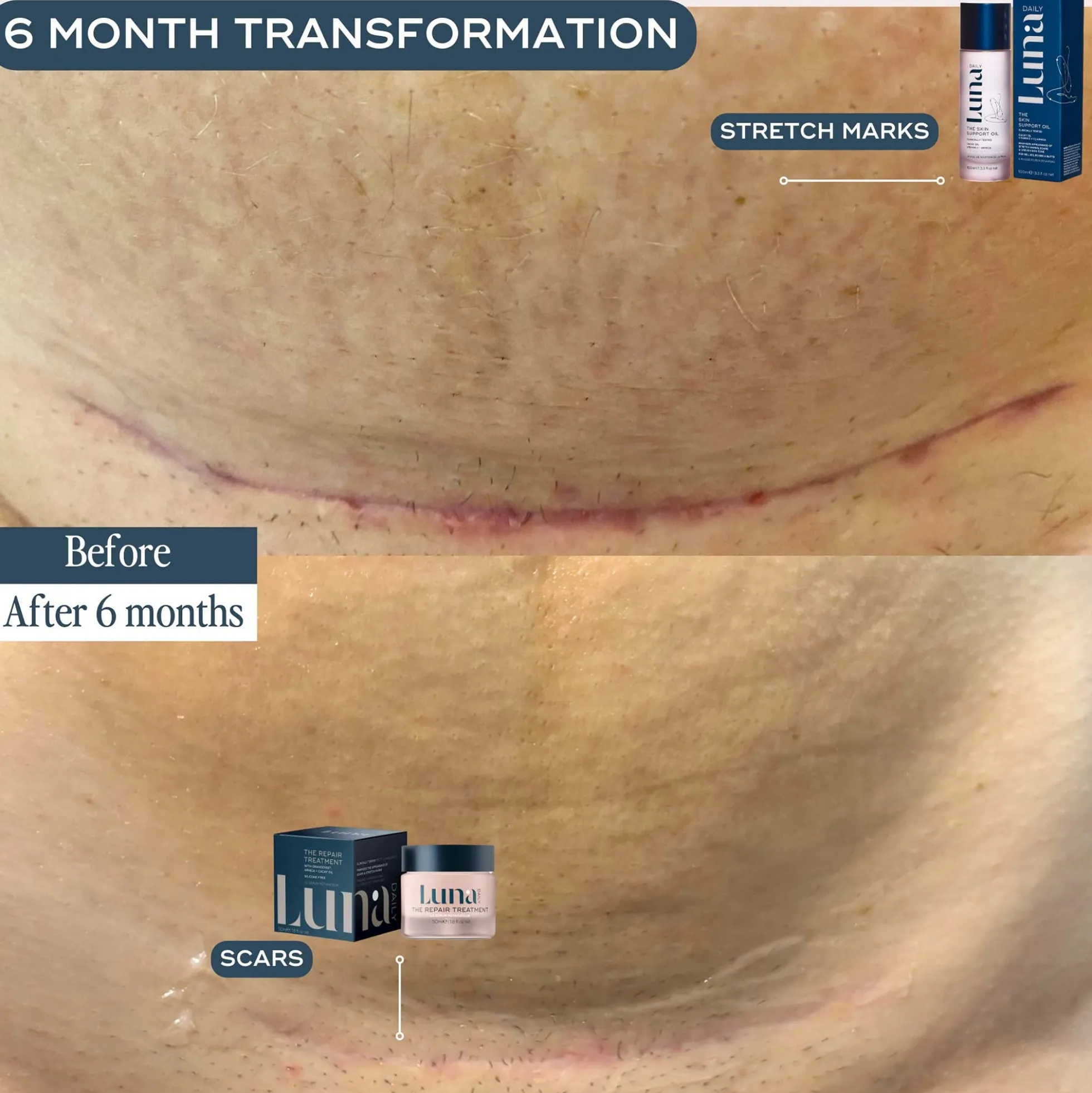 Luna Daily The Skin Repair Treatment for Scars and Hyperpigmentation 50ml