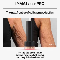 LYMA Laser Pro Starter Kit