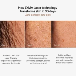 LYMA Laser Starter Kit