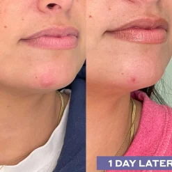 Mario Badescu Repairing Facial Spray with Hypochlorous Acid 118ml