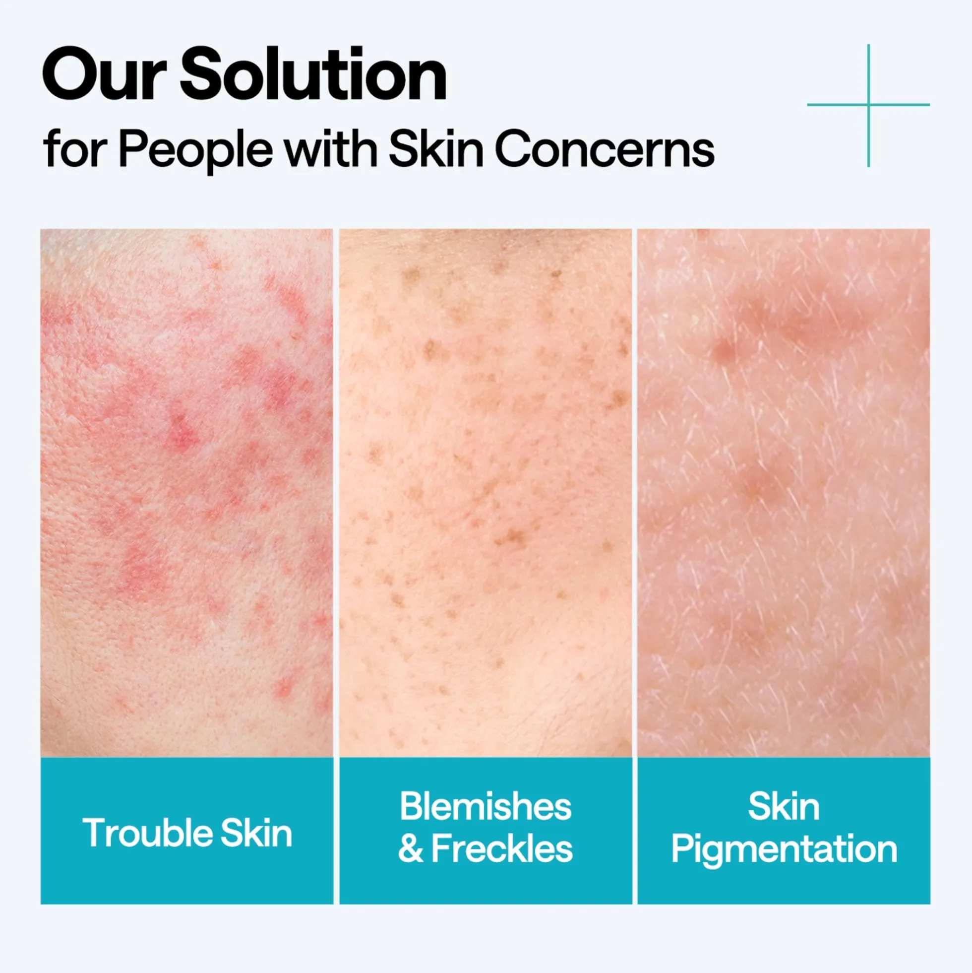 Mediheal Madecassoside Blemish Repair Serum 40ml