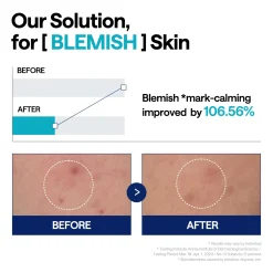 Mediheal Madecassoside Blemish Repair Serum 40ml