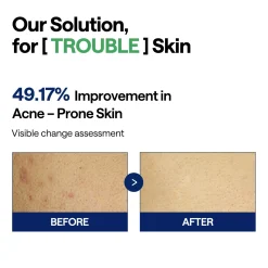 Mediheal Teatree Trouble Pads 100 Pads