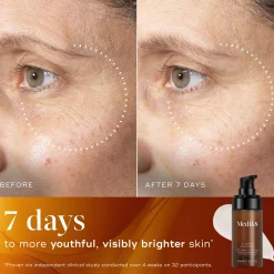 Medik8 C-Tetra Advanced 30ml