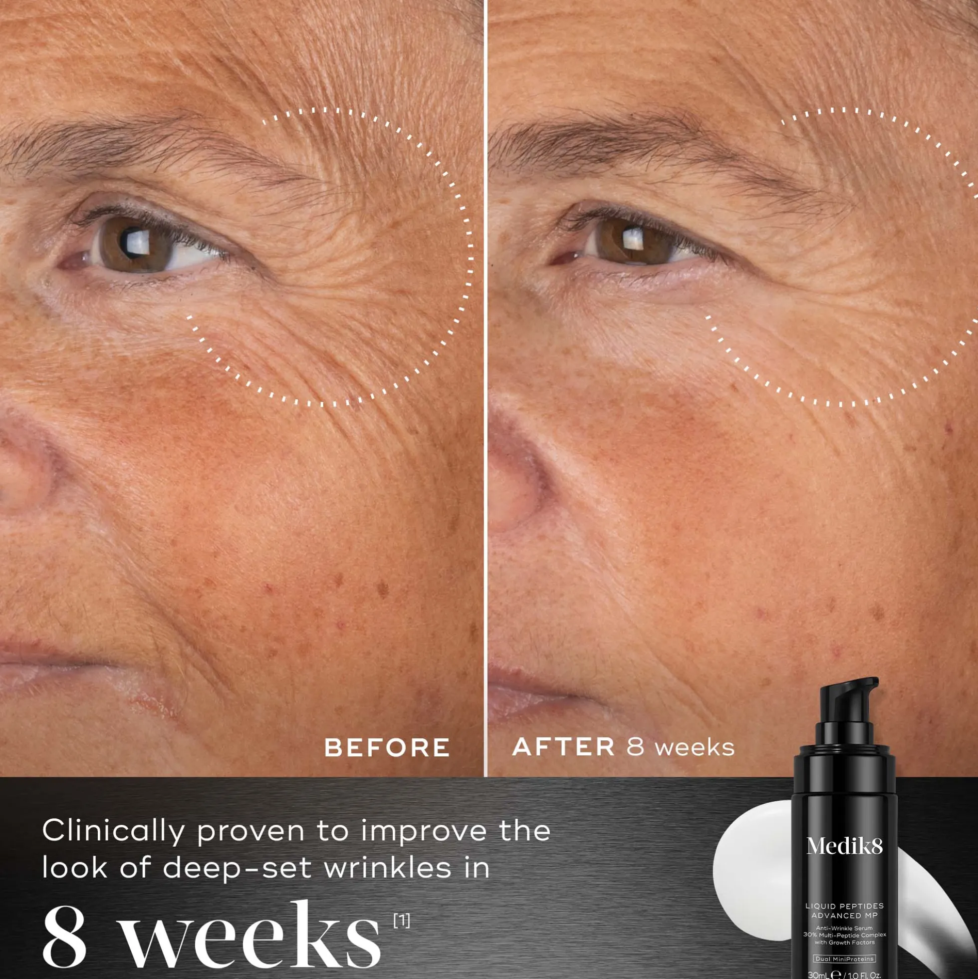 Medik8 Liquid Peptides Advanced MP 30ml