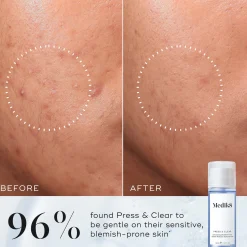 Medik8 Press and Clear Refill 150ml