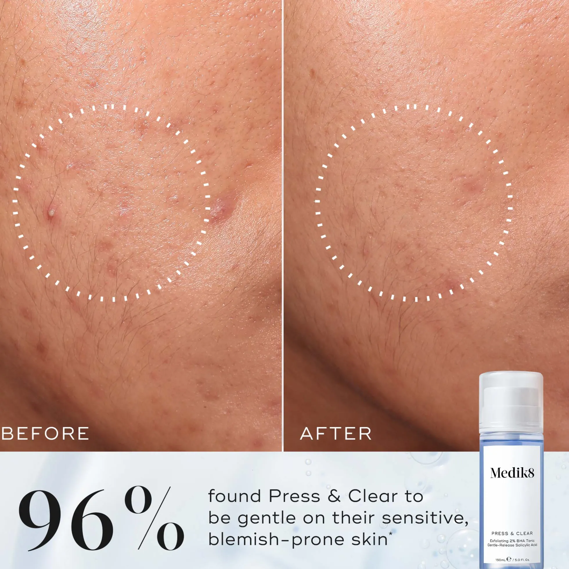 Medik8 Press and Clear Refill 150ml