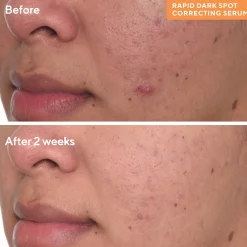 Murad Rapid Dark Spot Correcting Serum 30ml
