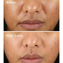 Murad Rapid Relief Sulfur Mask 75ml