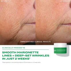 Murad Retinal ReSculpt Discovery (Worth £114.00)