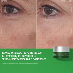 Murad Retinal ReSculpt Eye Treatment 15ml