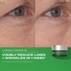 Murad Retinal ReSculpt Eye Treatment 15ml