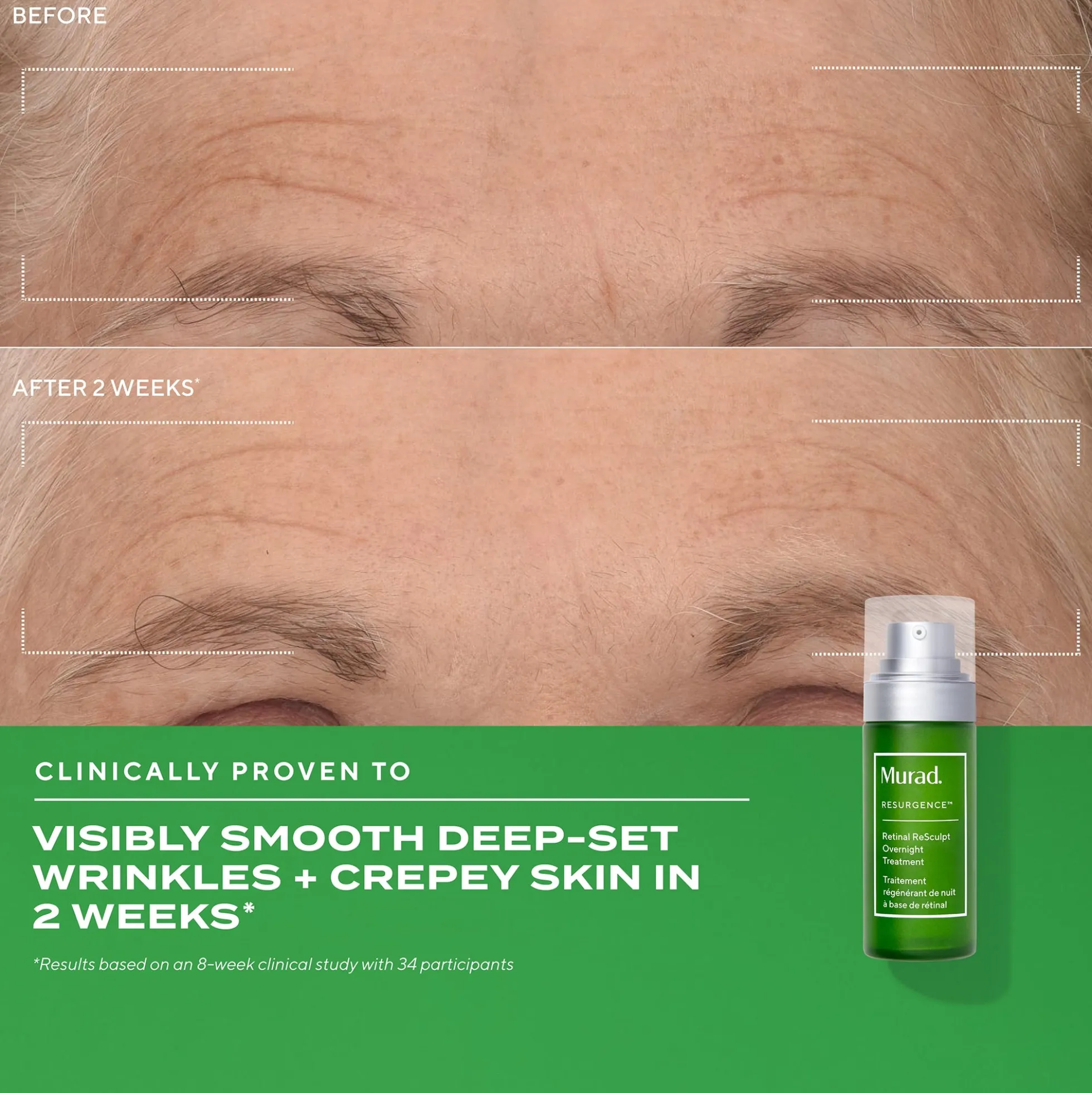 Murad Retinal ReSculpt Overnight Treatment 30ml