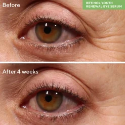 Murad Retinol Youth Renewal Eye Serum 15ml