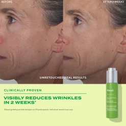 Murad Retinol Youth Renewal Oil Drops 30ml