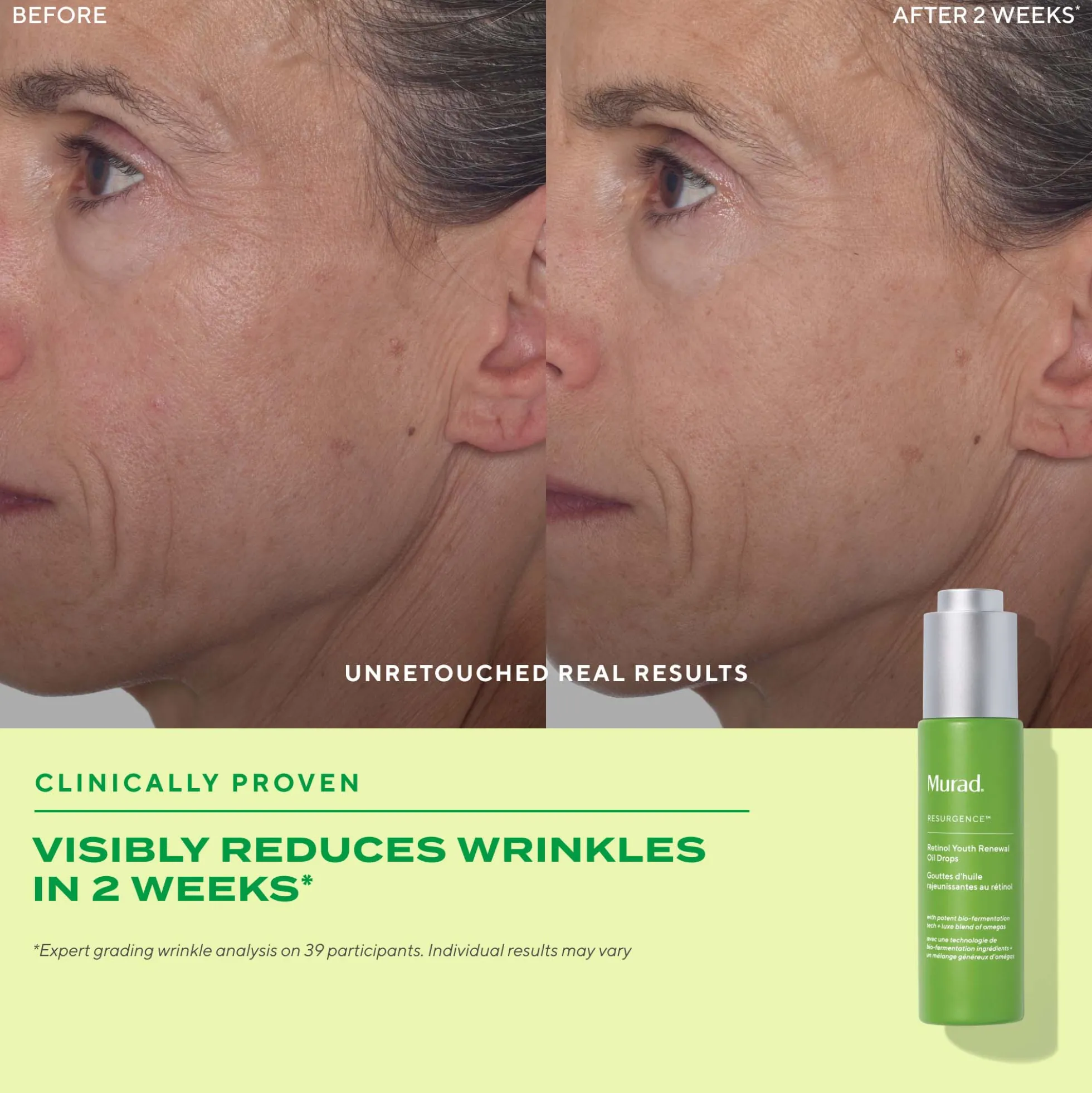 Murad Retinol Youth Renewal Oil Drops 30ml
