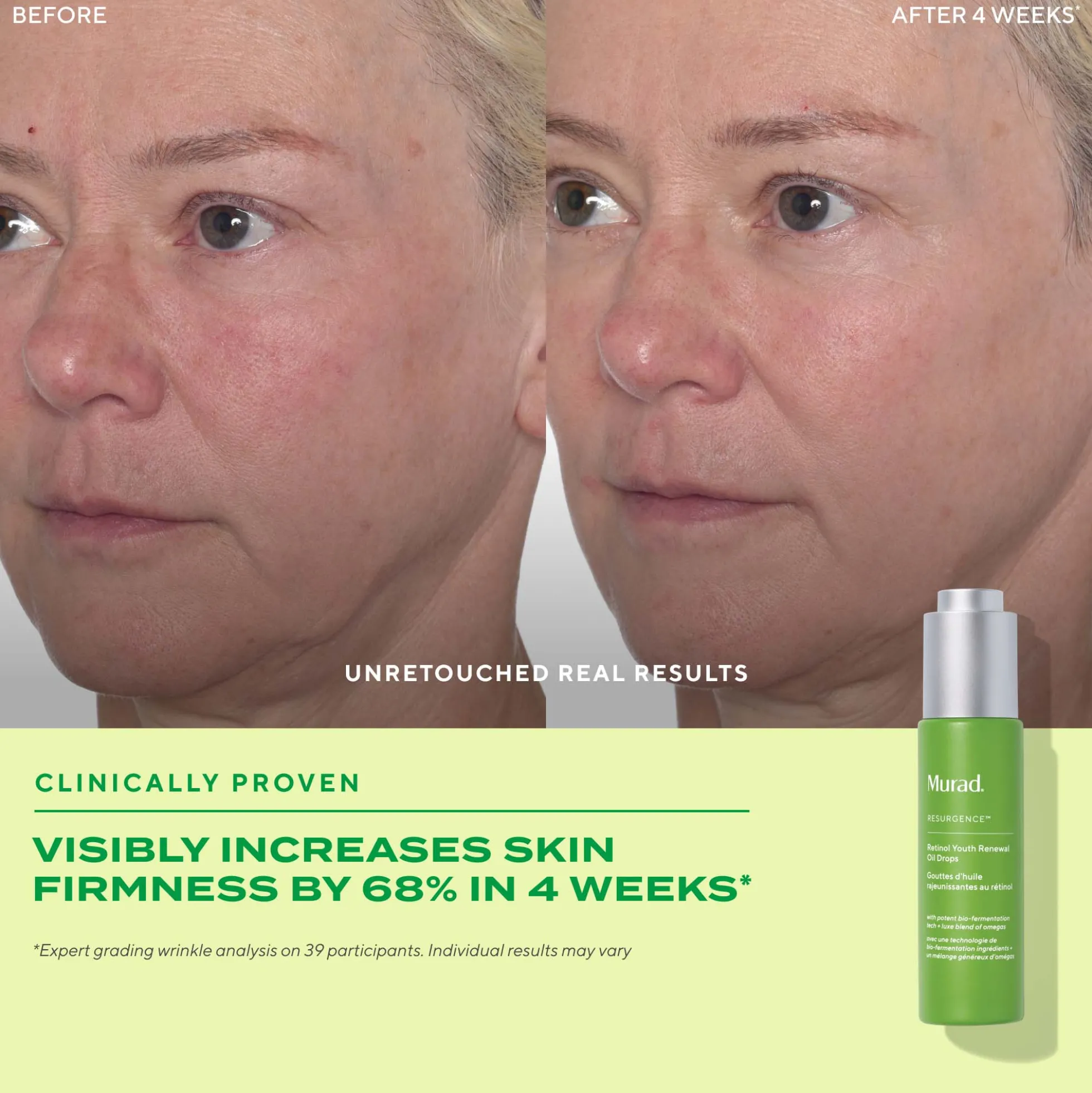 Murad Retinol Youth Renewal Oil Drops 30ml