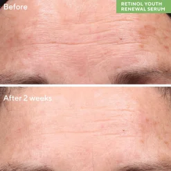 Murad Retinol Youth Renewal Serum 30ml