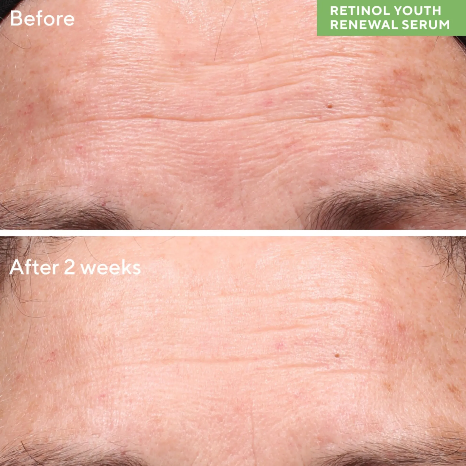 Murad Retinol Youth Renewal Serum 30ml