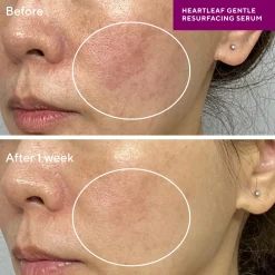 Murad Sensitive Skin Heartleaf Gentle Resurfacing Serum 30ml