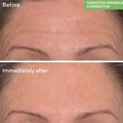 Murad Targeted Wrinkle Corrector 15ml